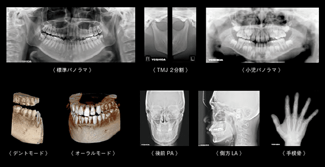 様々な歯のお悩みにCTが活躍します