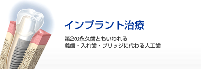 関歯科医院のインプラント治療