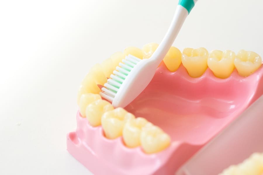 入れ歯を長く使うためには、天然の歯と同じくらいのケアが必要です