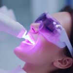 ホワイトニングの施術の様子