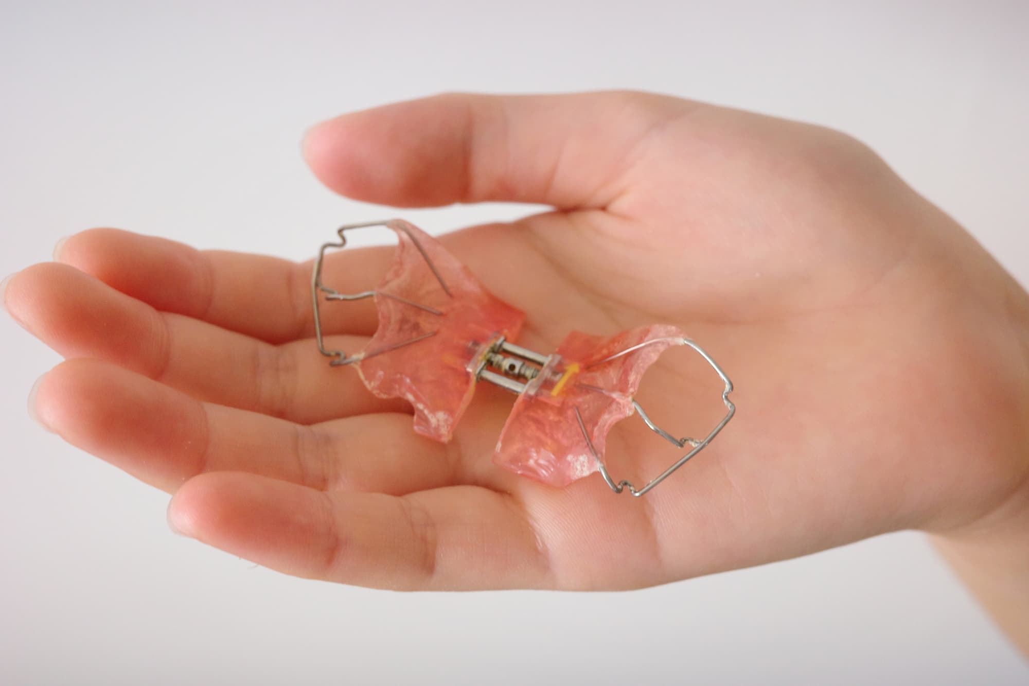 手のひらに乗せた床矯正の装置