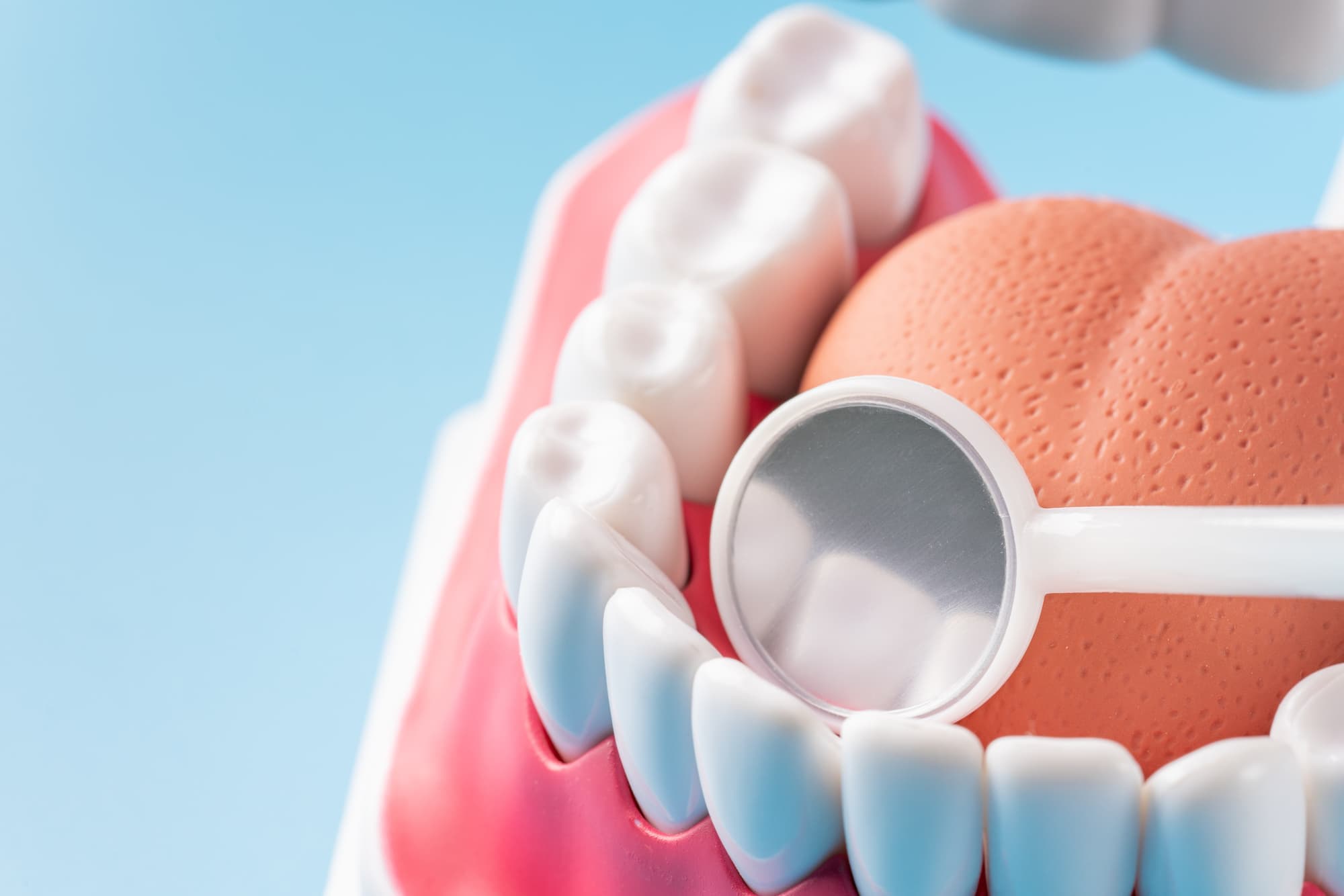 歯と歯の間に虫歯ができていないか確認するイメージ