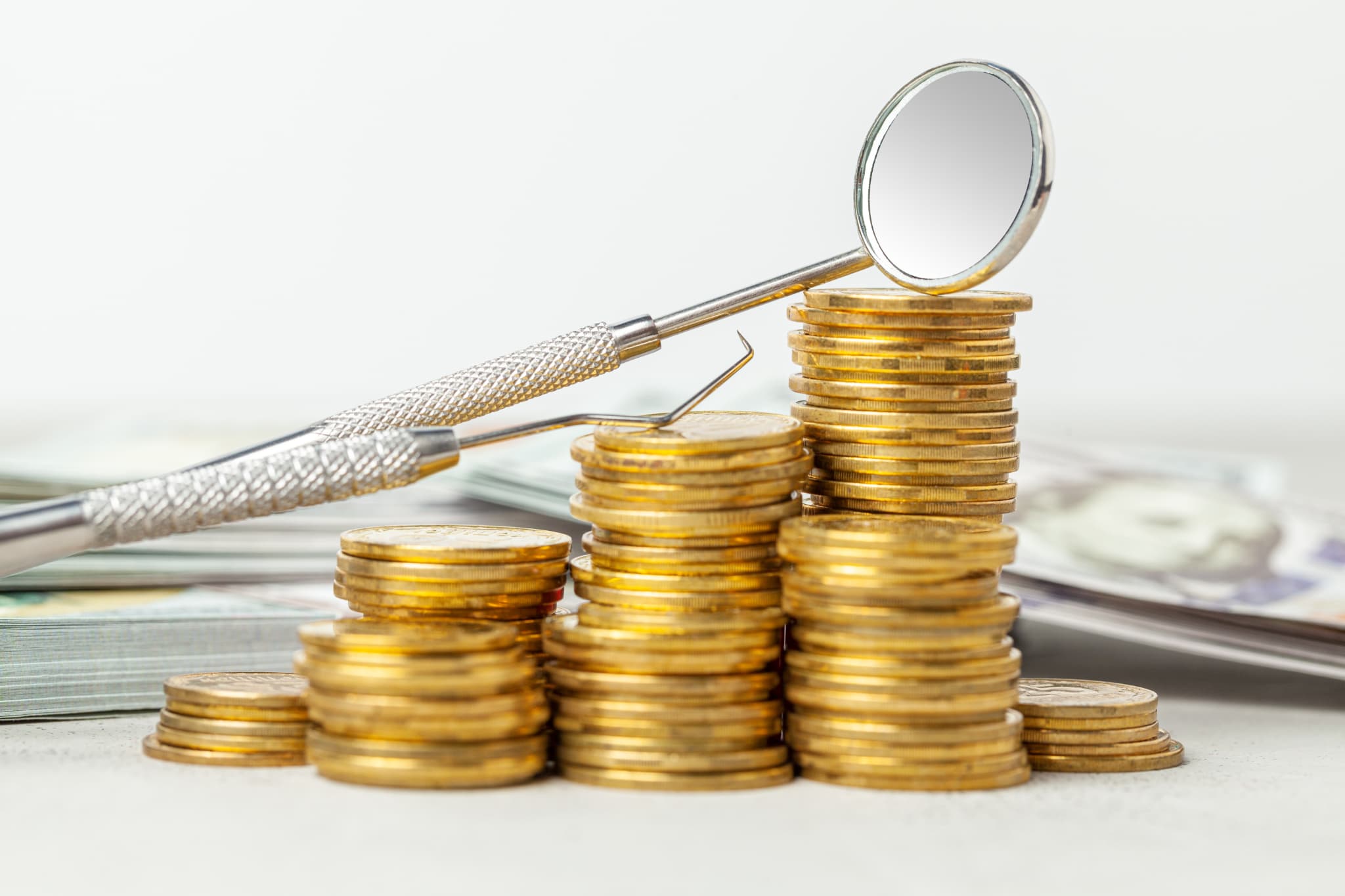 虫歯治療にかかる費用のイメージ