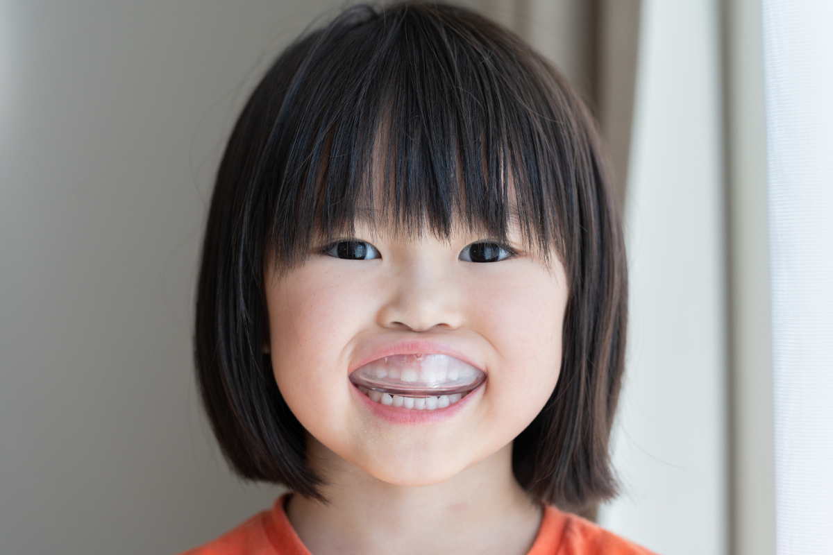 受け口の矯正治療中の子ども