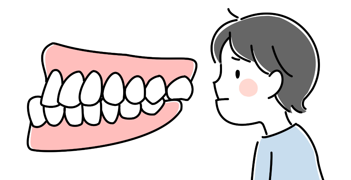 受け口の子どもの口の様子